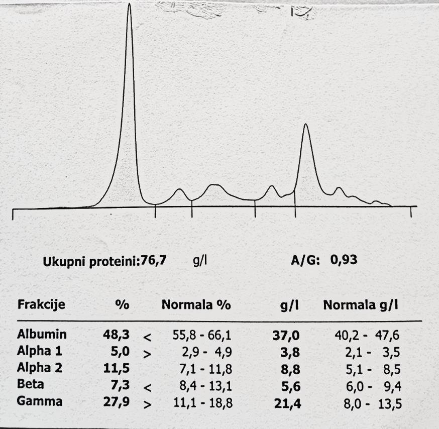 CZE vs agaroza gel elektroforeza Agaroza gel