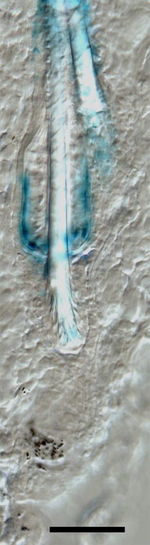 (A) Hair follicle morphology of a 15-month old mouse.