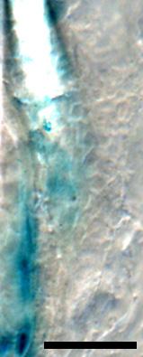 (B-G) Foxc1 expression is detected by LacZ staining and IF