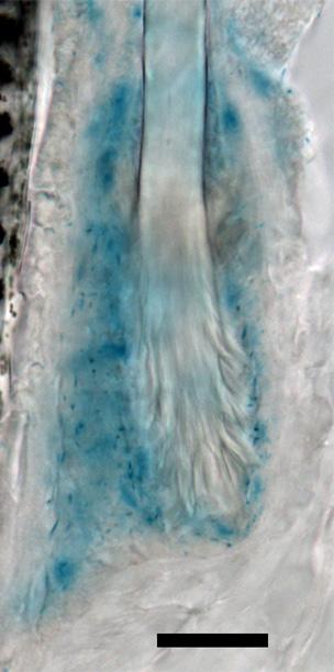 (B) Foxc1 expression is absent in the interfollicular