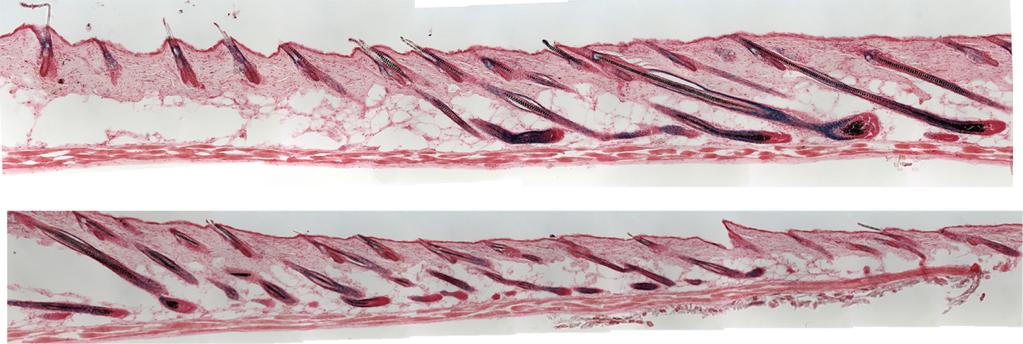 (C) Foxc1 expression is absent in the bulge and hair germ
