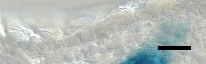 follicle.
