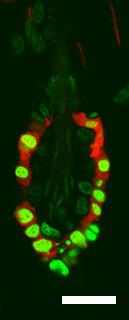 Supplementary Figure 2 Lineage-specific cre recombinase in HF bulge. (A) Foxn1Cre specifically induces Cre expression in K6+ suprabasal bulge layer (SBL).