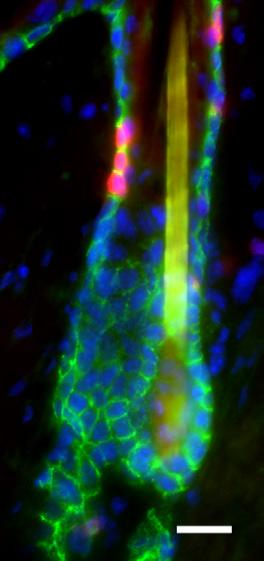 P30 # of Caspase3(+) cells