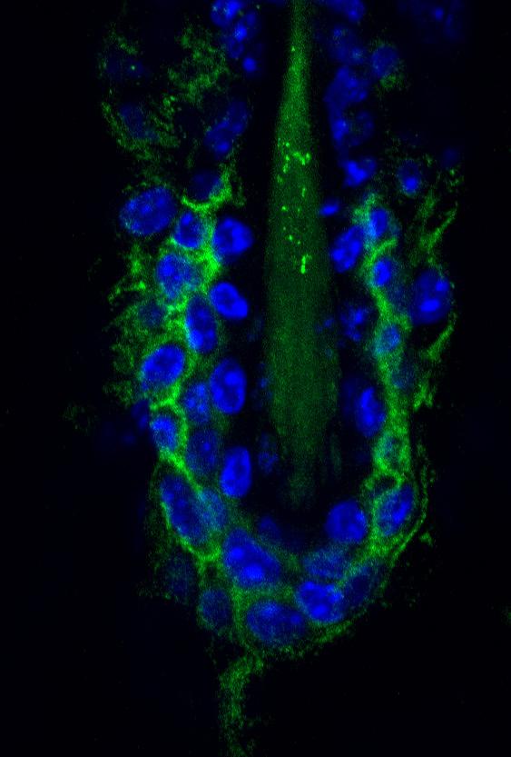 Supplementary Figure 7 Downregulation of CD34 when Foxc1 is depleted in