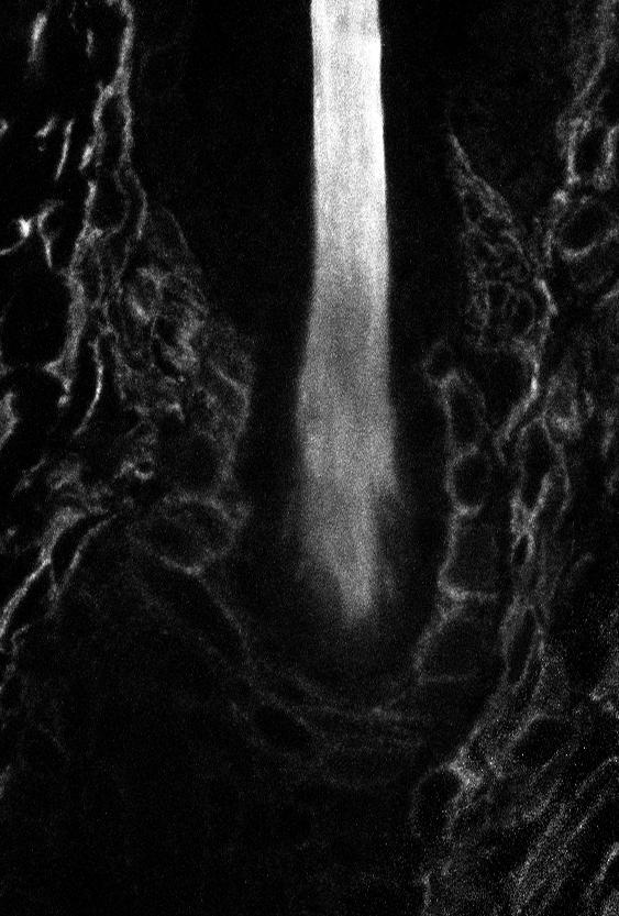CD34 immunofluorescence was examined in anagen bulge of WT, K14Cre cko, Foxn1Cre