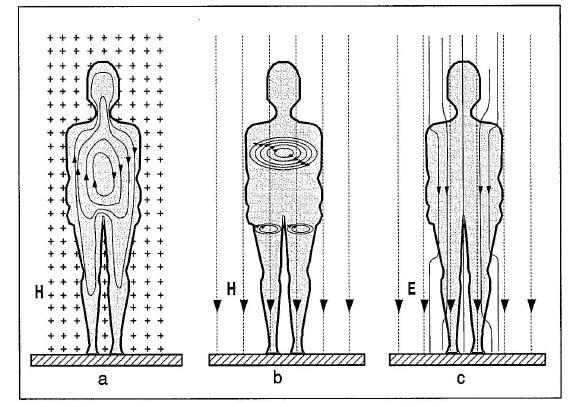 Twinning projekt: HR/2007/IB/OT/01 Slika 4: djelovanje statičkih E i B polja na nosioce naboja (B=μH, μ =μ 0 μ rel, μ rel za biološku materiju =1) U statičkom električnom polju na nepokretnu nabijenu