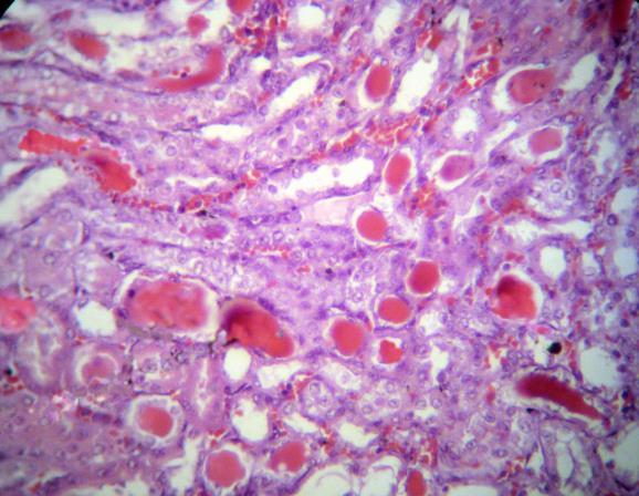 A B C D شکل 9: تاثیرCM hmsc- برتغییرات بافتی کلیه در حیوانات زدل آسی حاد کلیوی القا شده