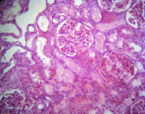Tissue injury score بررسی اثر محیط کشت حاصل از سلول های بنیادی مزانشیمی انسانی بر.