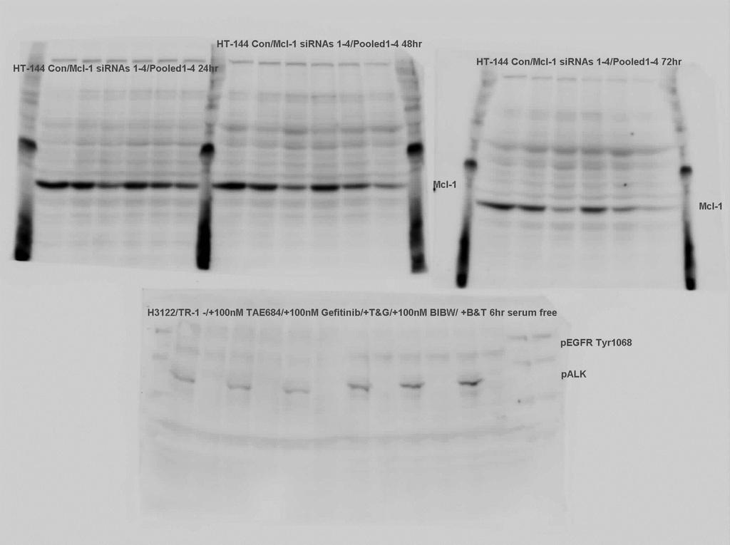 a MCL1 sirna / #1 #2 #3 #4 MCL1 β-tubulin b c c Supplementary Figure 7: MCL1 knockdown sensitises melanoma cells to ABT-263.