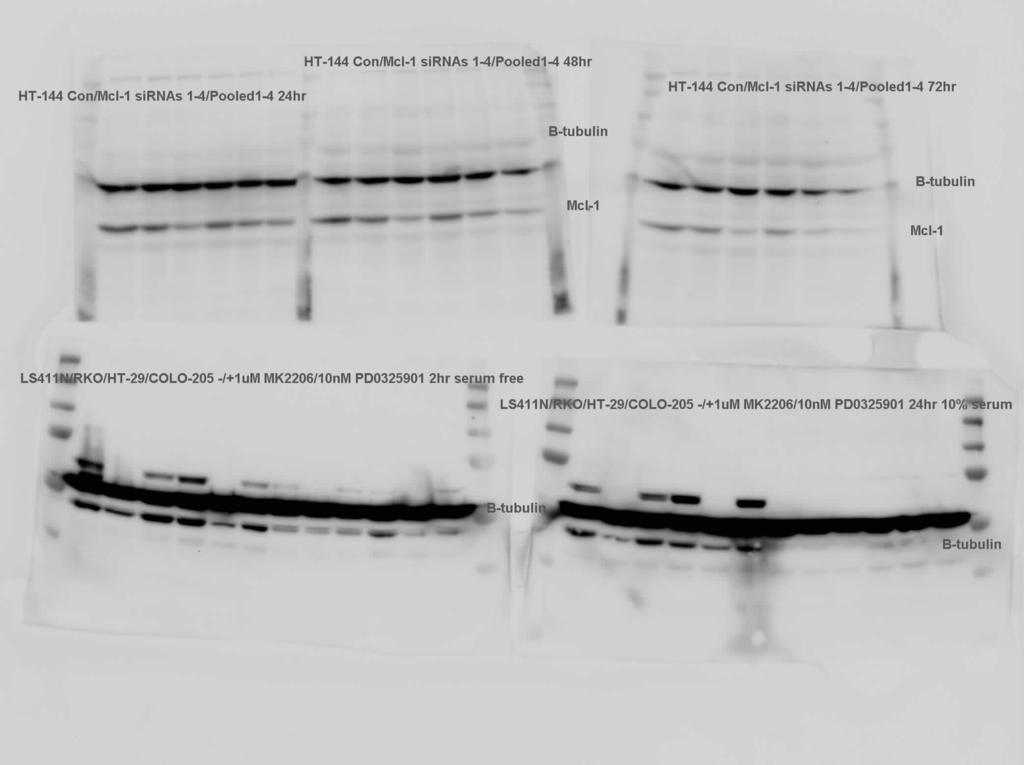 sirna #2 and #4 gave the most efficient knockdown and were selected for subsequent cell viability assays.