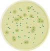 LISTERIA MONOCYTOGENES ALOA (Agar Listeria according to Ottavani and Agosti) - Sivo plave okrugle kolonije - detekcija beta glukozidaze korišćenjem specifičnih