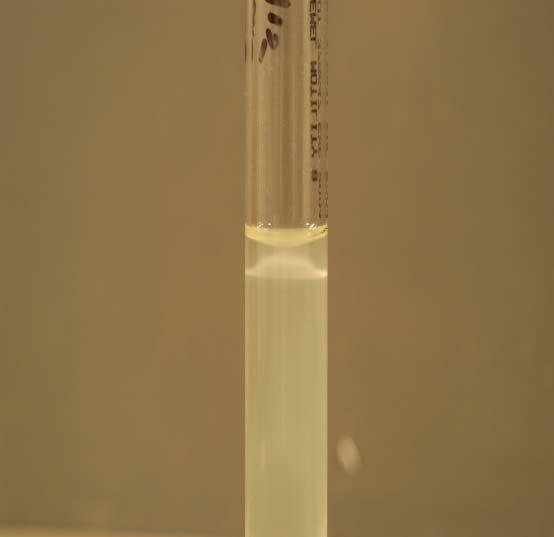 LISTERIA MONOCYTOGENES