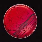SALMONELLA VRSTE - XLD agar (Xylose Lysine Desoxyholate agar) - Natrijum-dezoksiholat: inhibiše Gram+ bakterije - Fenol crveno: ph indikator (alkalna sredina-crveno - salmonele) - Fe-amonijum citrat: