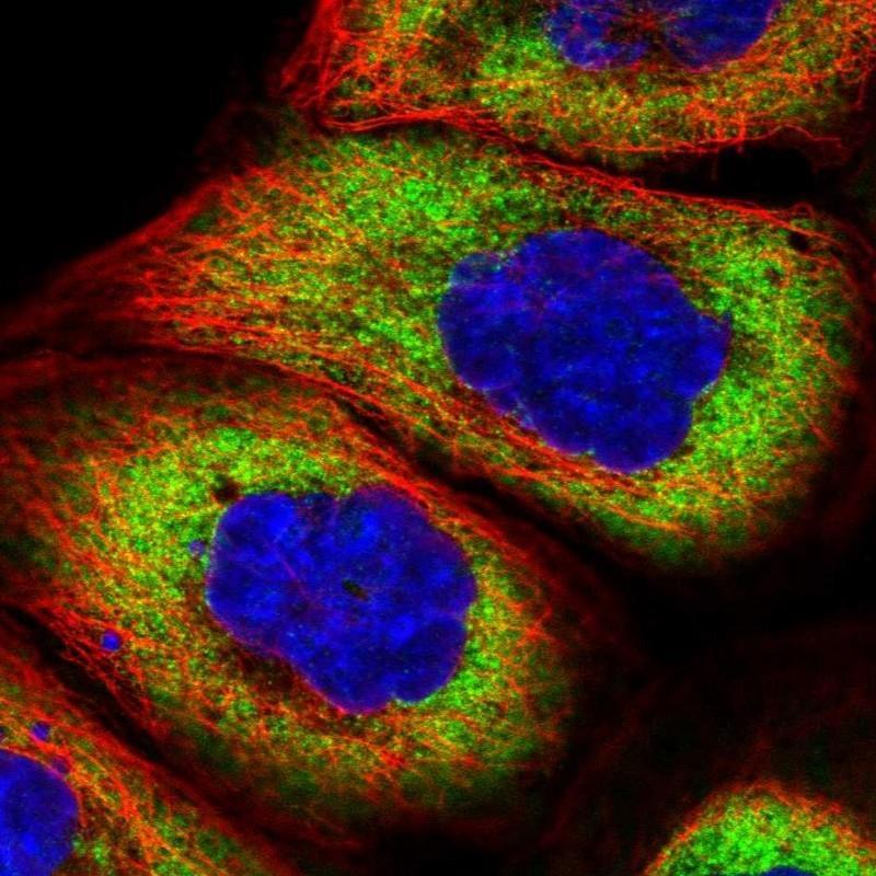 Kokkuvõte Aatomite elektronkatte ümberpaigutumise määr molekuli tekkimisel 3D-ruumis määrab selle molekuli omadusi.