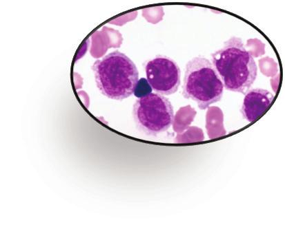NVP-AUY922 Selumetinib BIIB021