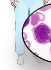 Trametinib Ruxolitinib Tanespimycin