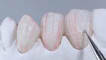 IPS Style Ceram