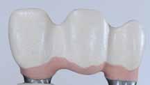 IPS Style Ceram Gingiva