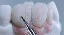 IPS Style Ceram Gingiva
