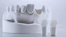Po peki Dentin/Impulse fasete