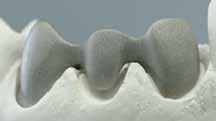 zlitine.