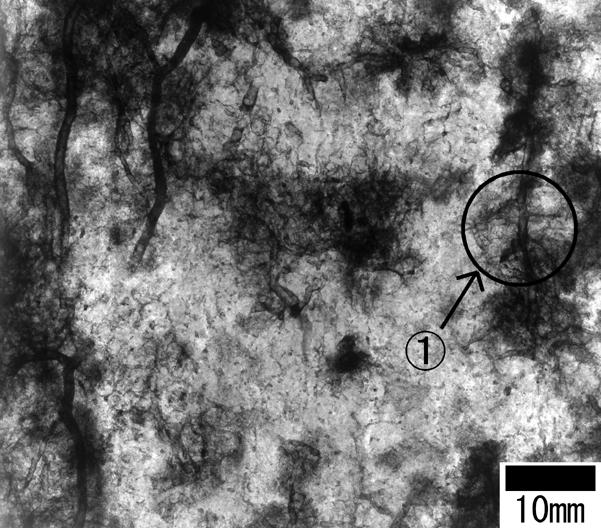 of tubular-pore (macropore) of