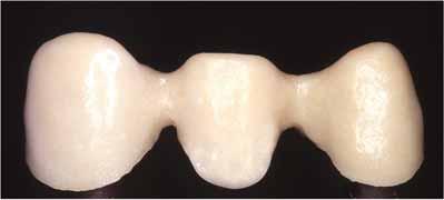 ALUMINA zakrije