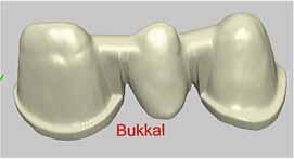 max ZirCAD.