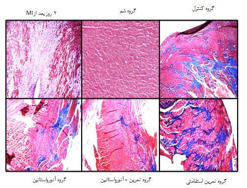 اثر ترکیبی تمرین استقامتی و داروی آتورواستاتین بر میزان آسیب نکروزی و بافت فیبروزی... هادی عبدی و همکاران نسبت وزن قلب به وزن بدن در گروه های تجربی نداشت.