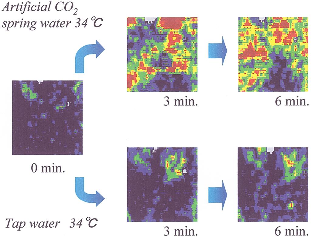 /,,**,, 19 Fig. / Laser doppler imaging of cutaneous blood flow of foot by CO, bathing (CO, concentration of +,*** ppm) and tap water bathing at -.