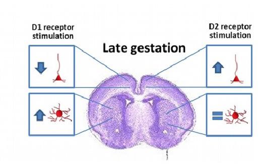 مروري مقاله 1393 طول در )Striatal medium spiny neurons( مخطط جسم متوسط خاردار نهای نورو و قشری هرمی نهای نورو آکسون( و )دندریت زوايد بر دوپامین گیرنده های تأثیر 3- تصویر رد تصویر( چپ )سمت یشوند م