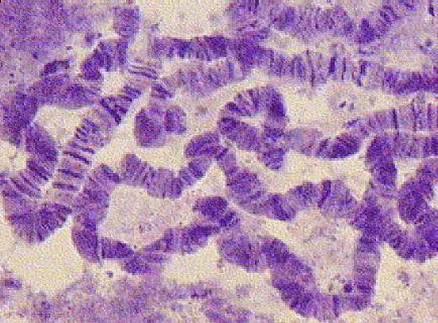 Politeni hromozomi pljuvačnih žlezda Drosophila