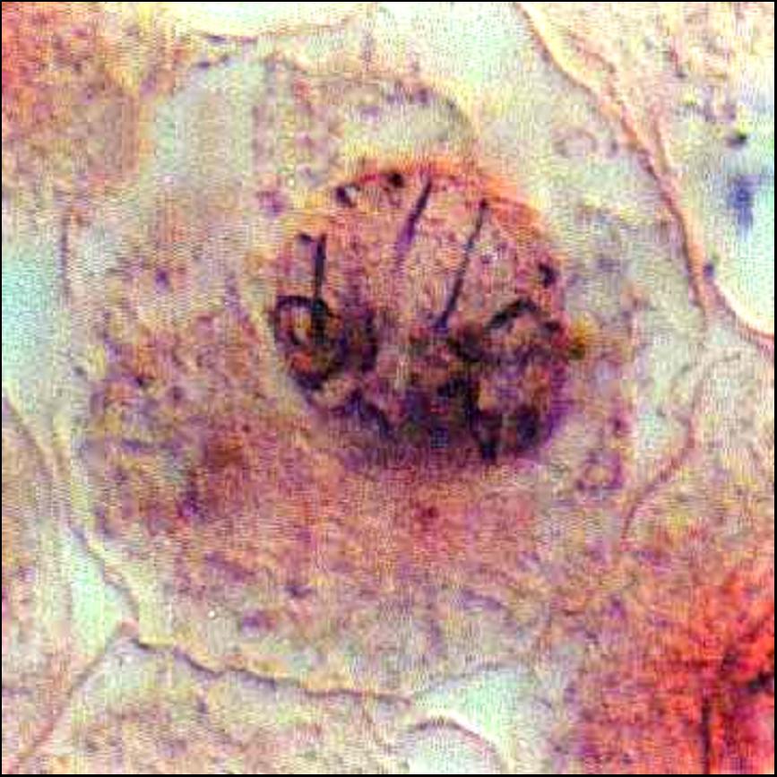 d Mitoza somatskih ćelija
