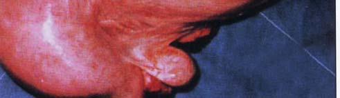 piometra kobila glandularna