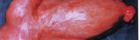 Piometra kao posljedica