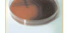 Pseudomonas