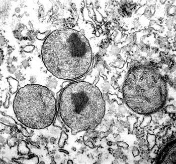 Peroksizomi (mikrotela) Organele u obliku vezikula koje poseduju 1 membranu, dijametra 0.1 1 µm. Prisutni kod svih ćelija životinja, najbrojniji i jetri i bubrezima.