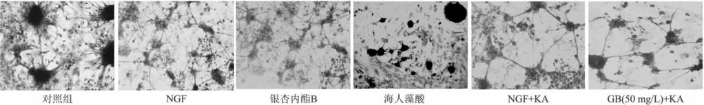 284 21 2. 3 P < 0. 01 B 4 h NGF + KA 3 1 10 h 3 24 h n = 6 x ± s Tab 3 Colony differentiation ratio of embryonic rat midbrain neurons cultured in different groups 10 d B NGF NGF 94. 3 ± 3. 20 125.