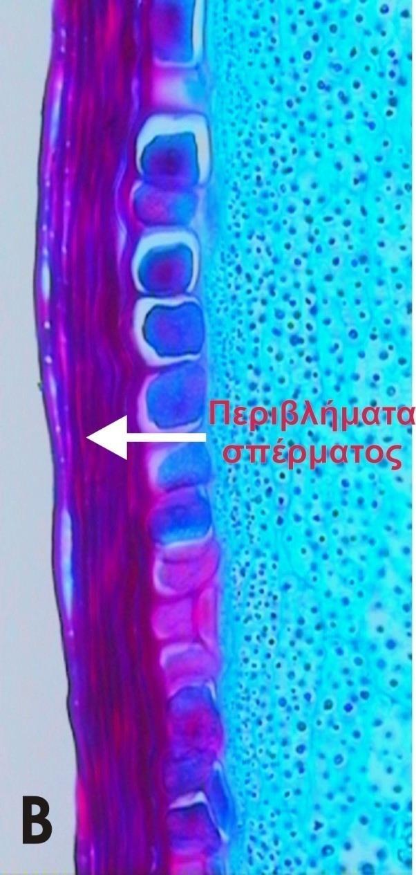 Α. Επιμήκης τομή σπέρματος ενός