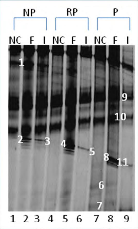 Προβιοτικά Προϊόντα Κρέατος DGGE-PCR ανάλυση του βακτηριακού πληθυσμού (Sidira et al., 2014b) Band a Most closely related species Identity (%) Accession Number b 1 Lactococcus sp. 14A 100 HQ289889.