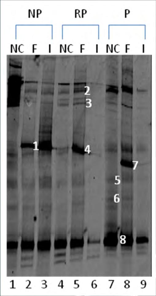 Προβιοτικά Προϊόντα Κρέατος DGGE-PCR ανάλυση ευκαρύων (Sidira et al., 2014b) Band a Most closely related species Identity (%) Accession Number b 1 Saccharomyces cerevisiae strain NL32 97 JX141338.