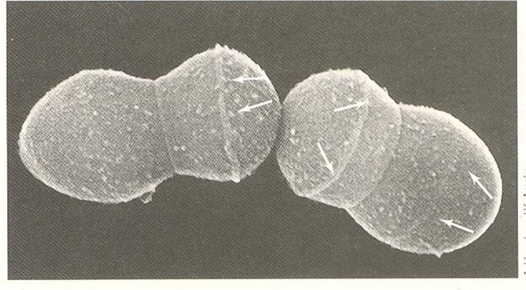 Σχ.113. Ηλεκτρονιακό μικρογράφημα Streptococcus hemolyticus. Τα βέλη δείχνουν τις ζώνες του τοιχώματος.