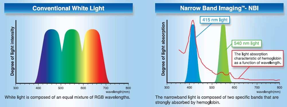 Narrow Band