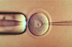 Διαγονιδιακοί ποντικοί Ζυγωτό 1. Γονιμοποιούμε το ωάριο στο εργαστήριο 2. Εισάγουμε σε αυτό το επιθυμητό DNA με μικροβελόνα 3.
