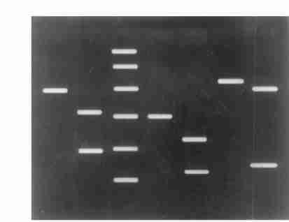 396 16, U CP1 Β2actin o ligo (dt ), U CP2 U CP3 3 (an ti2sen se), g RNA M 2M L v 80 U, 75 l, 37 2 h, 5140 mu gl ), 48 h cdna ; PCR 410 l, 64% (P < 0105) 83% (P < 300 nm o lgl, T aq DNA 0101), 215 U,