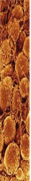 LOW FREQUENCY ULTRASOUND (CAVITATION) The sound can be considered as a succession of