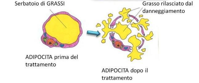 ULTRASOUND CAVITATIONAL EFFECT Low Frequency Ultrasound BIGGER BUBBLES (+28 KHZ not higher than 40 KHZ ) Lipid droplet