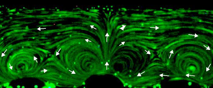 ADIPOSITY DEPTH: POTENTIALLY INFINITE Adipocyte before the treatment Adipocyte after treatment High Frequency Ultrasound