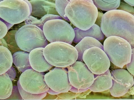 WATER IN ADIPOSE TISSUE PHYSIOLOGICAL CONTENT OF WATER IN THE INTERCELLULAR